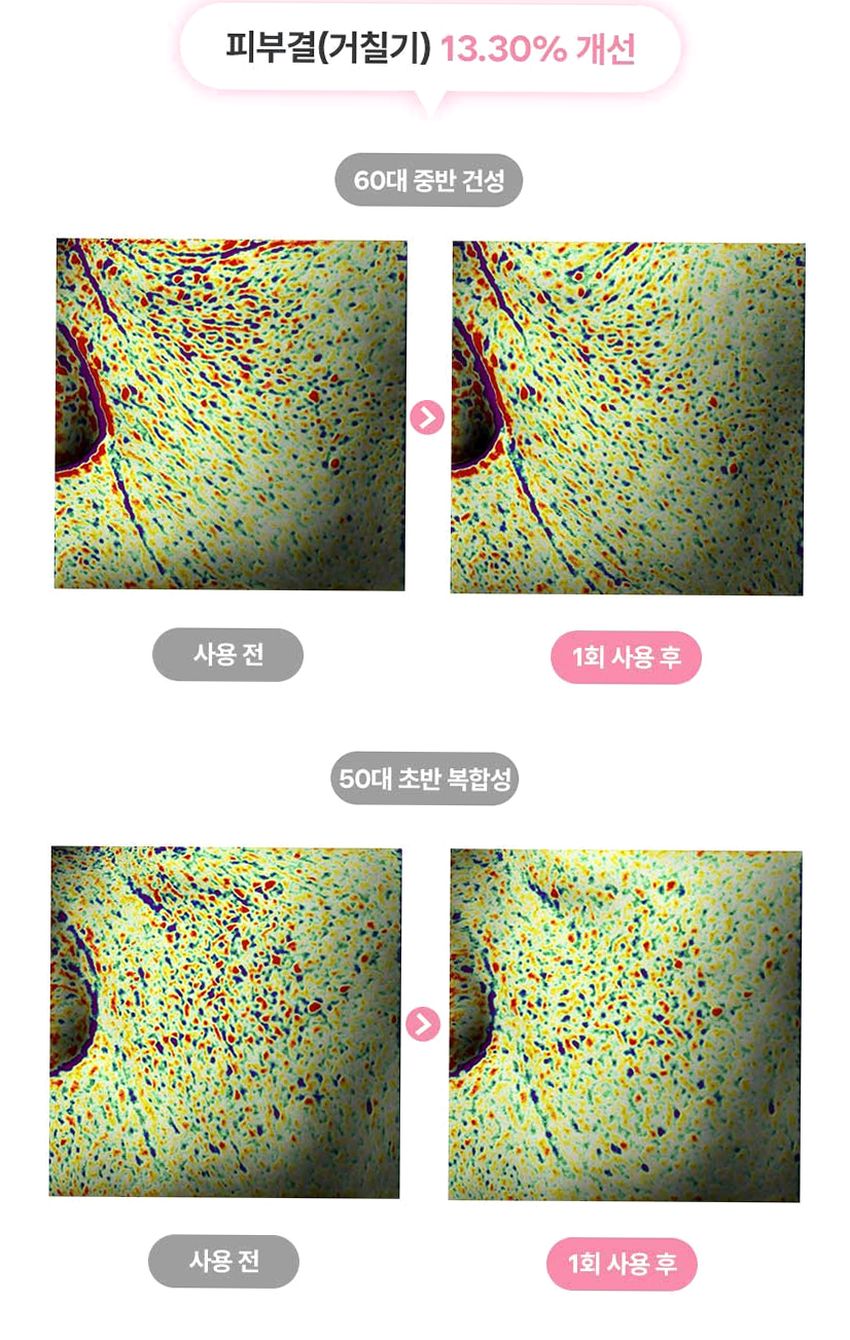 펄리 엑소좀 피부과재생크림 수분 보습 시카 히알루론산 물광크림 40ml, 1개